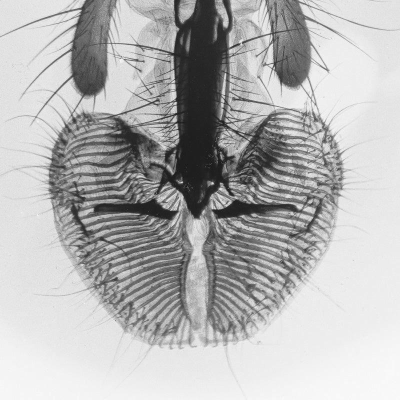 Microscopy - Bug Face Ultra Closeup