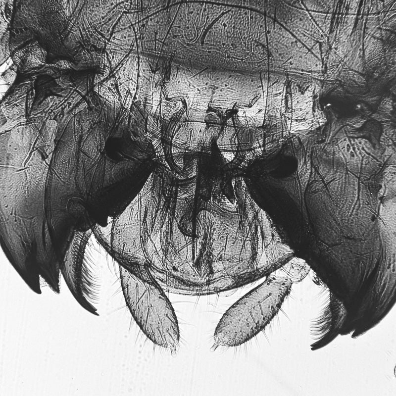 Microscopy - Bug with Powerful Mandibles